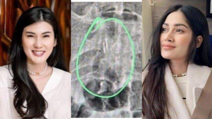 Anaknya Didoakan Cacat Imbas Isu Santet Stevie Agnecya, Icha Annisa Muak: Hati-hati Keluarga Kamu!