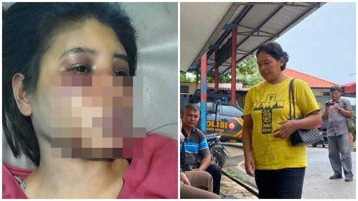 Pengakuan Pilu ART Dianiaya Majikan di Batam, Tubuh Penuh Luka Lebam, Tak Pernah Terima Gaji Utuh
