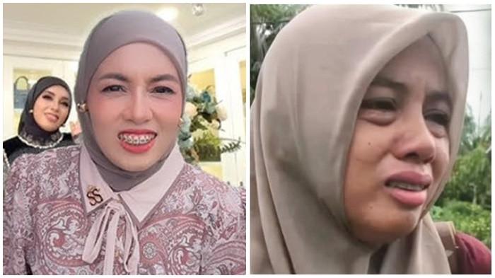 BEHEL Gigi Melda Safitri Disorot, Kena Nyinyir setelah Terkenal Akhirnya Angkat Bicara 'Untuk gaya'