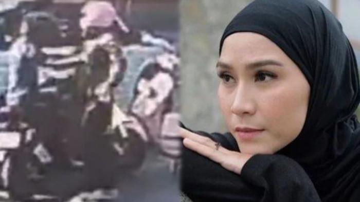 PEMUKULAN KARYAWAN - Penjaga rumah artis Zaskia Adya Mecca dipukul orang tak dikenal di Jalan Ampera Raya, Jakarta Selatan, Senin (22/9/2025)