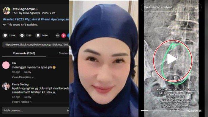 Penyebab Stevie Agnecya Meninggal Dunia Belum Diungkap, Sempat Tunjukkan 'Benda Asing' Hasil Rontgen