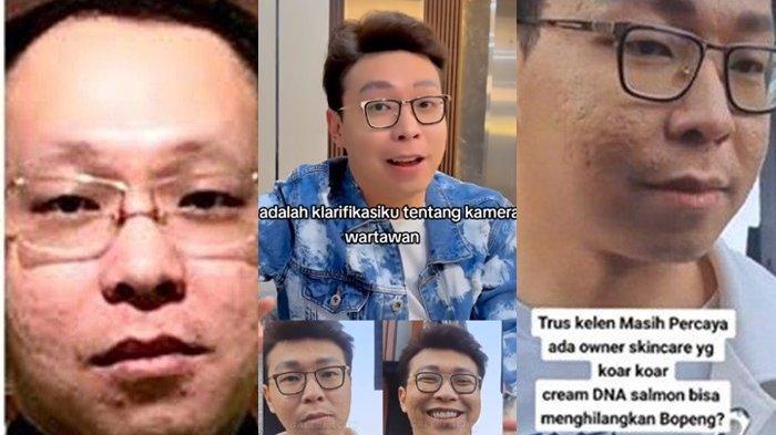 Klarifikasi Richard Lee soal Wajah tak Sesuai Ekspektasi Sekelas Bos Skincare, Salahkan Kontras HP