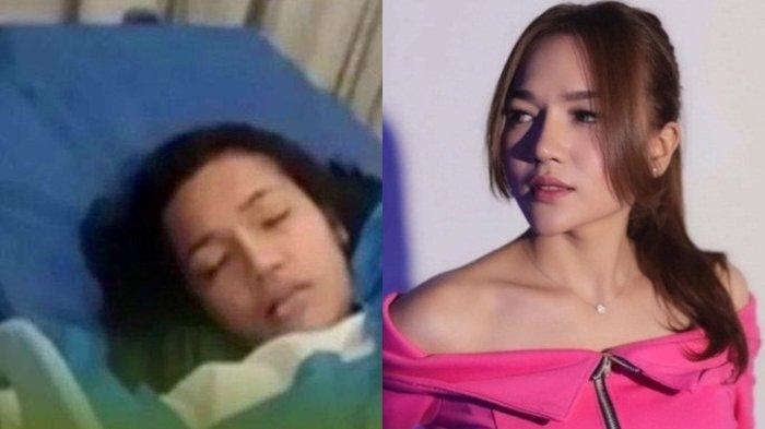 Selebgram Medan Ella Nanda Meninggal Usai Sedot Lemak Alami Pecah Pembuluh Darah, Polisi Kuak Sebab