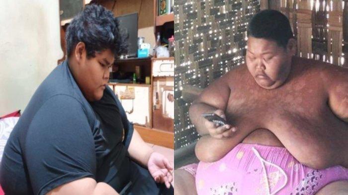 SOSOK Sungadi dan Ahmad Juwanto yang Derita Obesitas, Lari Saat Ambulans Datang hingga Putus Sekolah