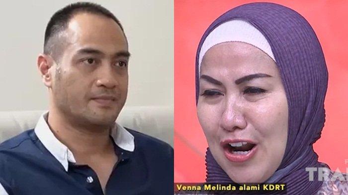Malu tak Punya Pekerjaan jadi Alasan Ferry Irawan KDRT Venna Melinda, Ada Bukti Tulang Rusuk Patah