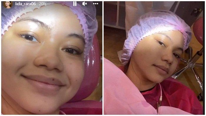 Wajah Natural Rara LIDA Curi Perhatian, Tangan Lincah Pedangdut Muda Ini Saat Berdandan Tuai Pujian