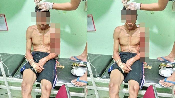Petani Durian di Ulu Ogan OKU Ini Dibacok Gara-gara Dituduh Memungut Durian Runtuh