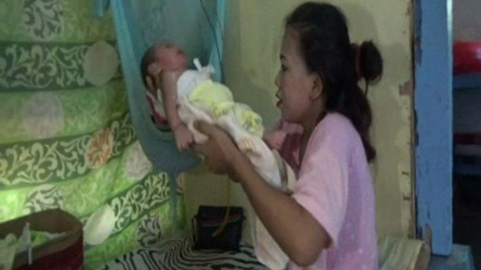 Lahirkan Bayi Berkelamin Ganda, Pasutri di Polewali Mandar Ini Bingung Beri Nama Anaknya