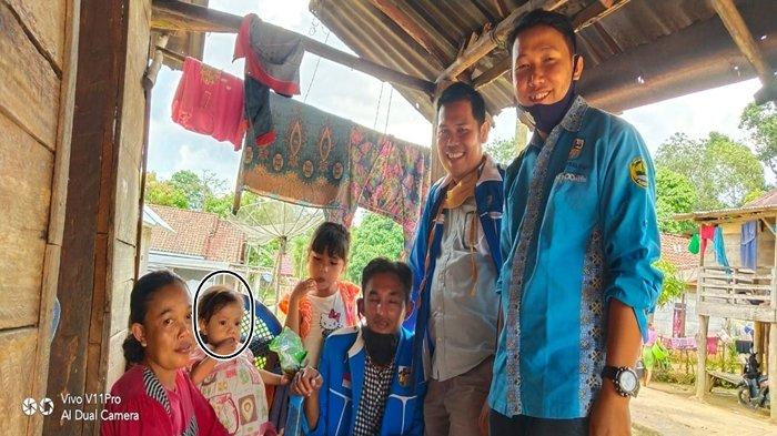 Ibu di PALI Ini Berkaca-kaca Ceritakan Kesulitan Anaknya Dua Tahun Sulit BAB, Kini Berbaring Lemah