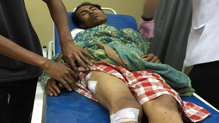 Cerita Dedi, Dibegal Penumpang Nyaris Tewas Usai Ditusuk 10 Lubang dari Belakang