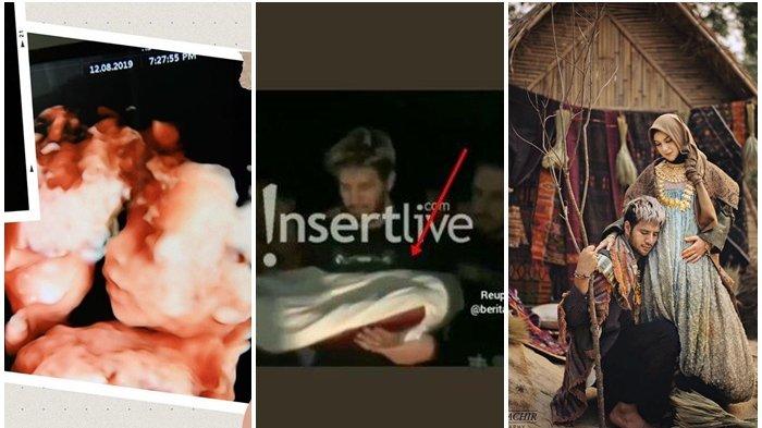 Dokter Ungkap Penyebab Bayi Kembar Ammar Zoni & Irish Bella Meninggal, Jadi Pembelajaran Masyarakat