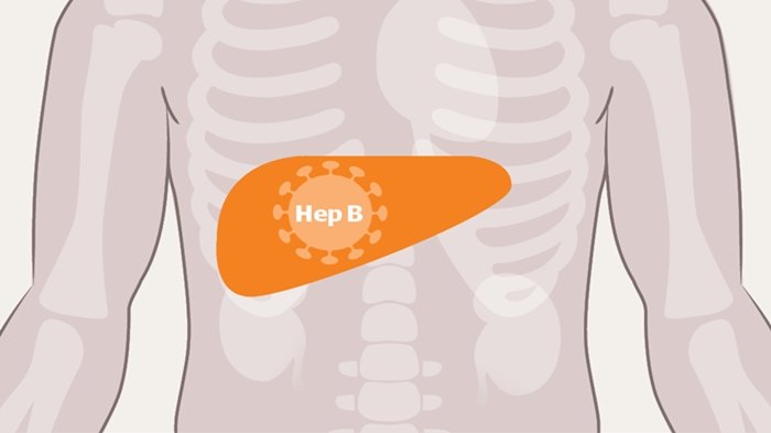 Penting, Hepatitis B Berdampak Buruk Pada Kesuburan Pria, Begini Penjelasannya
