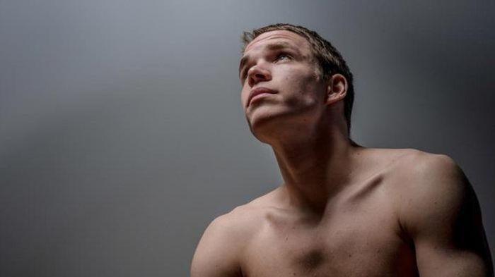 Puting Keluarkan Susu, Pria Ini Ternyata Derita Tumor Otak