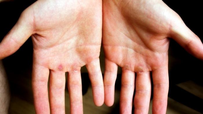 Inilah Tangan yang Tidak Akan Pernah Disentuh Oleh Api Neraka Selama-Lamanya