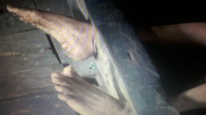 Camat Paiker tak Tahu Ada Warganya Dipasung Selama 25 Tahun