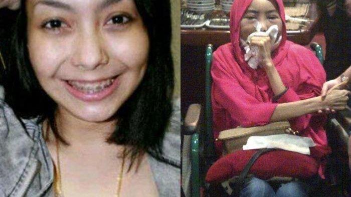 Artis Ini Meninggal Karena Kanker Lidah Ternyata Hal Sepele Ini Penyebabnya yang Sering Tak Disadari