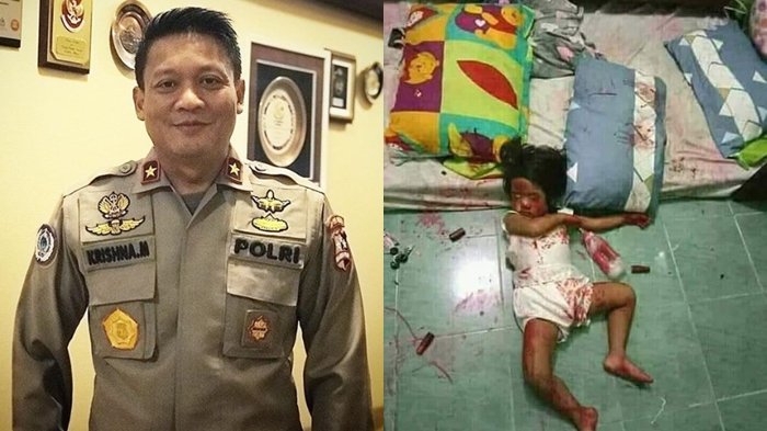 Posting Bocah Penuh Bercak Merah, Brigjen Pol Krishna Murti Ingatkan Orangtua, Faktanya Greget