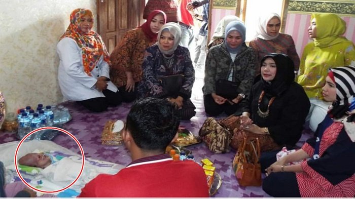 Milawati Zulkarnain Bersama Bhayangkari Sumsel Kunjungi Bayi Penderita Hydrocephalus Afifah Thalita