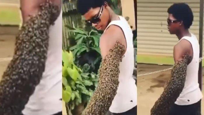 Pria Bertangan Lebah Lagi Viral, Bikin Kaget Netizen