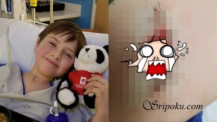 Hanya Karena Jatuh dari Sepeda Bocah 8 Tahun Ini Meninggal, Ternyata Disebabkan Hal Tak Terduga Ini