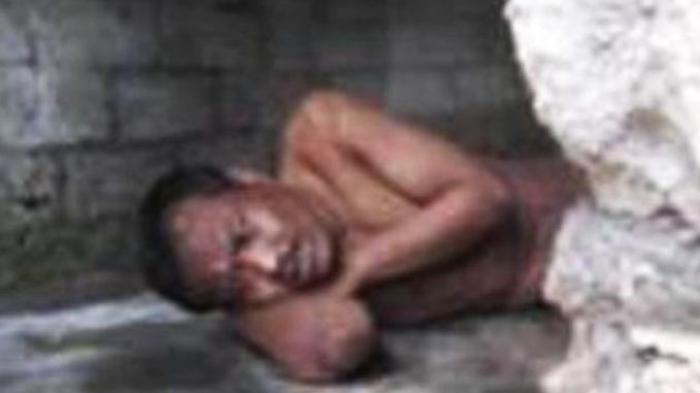 Mashuri Sudah 15 Tahun Hidup Dalam Pasungan dengan Kondisi Telanjang