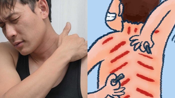 Begini Cara Mencegah Masuk Angin Bagi Yang Suka Keluar Malam