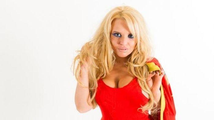 Terobsesi Mirip Pamela Anderson, Wanita Ini Rela Habiskan Rp 300 Juta