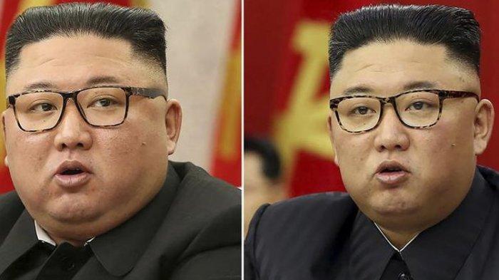 Perubahan Bentuk Wajah Kim Jong Un Terlihat Lebih Kurus, Warga Korea Utara Khawatir, Apa Sebabnya?