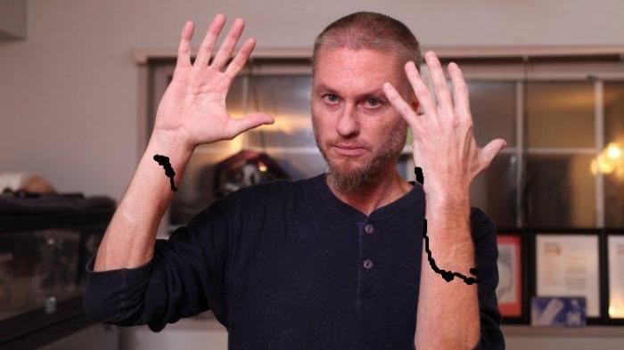 Lebih dari 165 Kali Digigit Ular, Pria Ini Jadi Kebal Racun