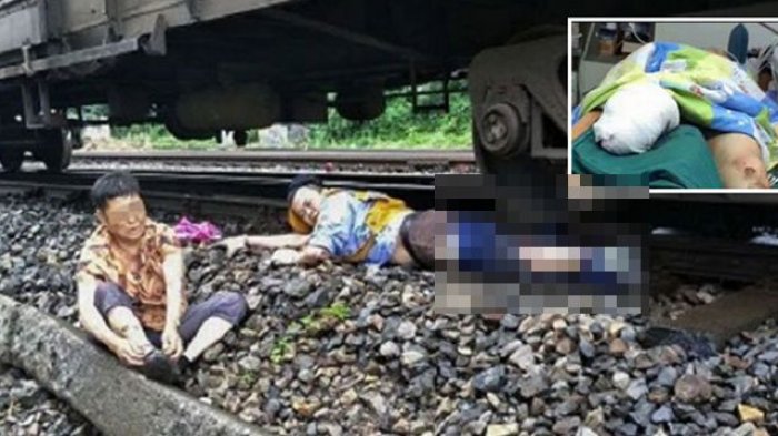 Bikin Terharu, Selamatkan Wanita Tua, Pria ini Rela Rasakan Sakit Saat Kakinya Dilindas Kereta Api