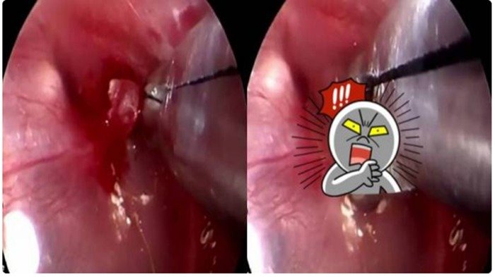 Pasien Mengeluh Sakit di Bagian Ini, Lihat Videonya Bikin Netizen Minta Dicek Semua Lubang di Tubuh