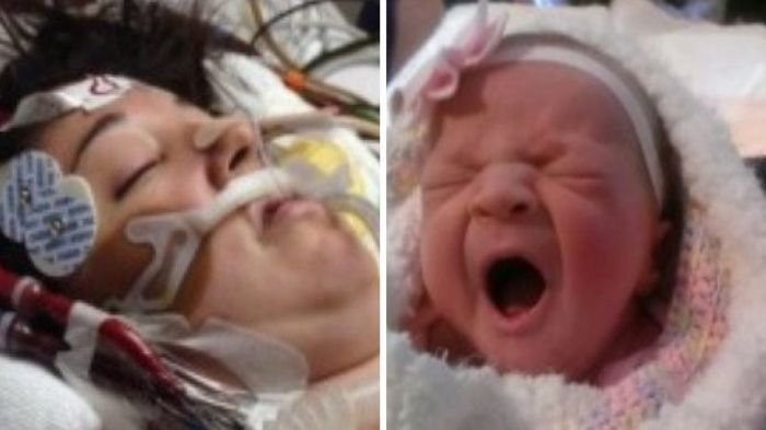 Wanita ini Koma Setelah Lahirkan Anak secara Sesar, Saat Semua Menangis, Dokter Lakukan Hal ini