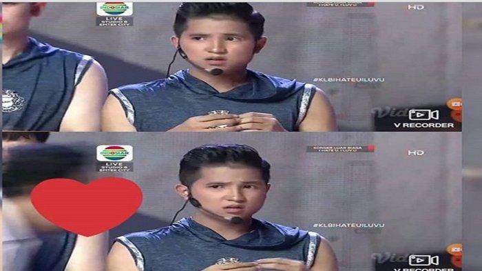 Pulang ke Indonesia, Jirayut Unggah Foto Kepala Diperban, Sohib Irfan Hakim Cerita Fakta tak Terduga