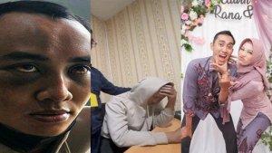 Kondisi-Calvin-saat-Ditemukan-Keluarga-Usai-Hilang-di-KDRT-Istri-Keluarga-Kuak-Nasib-Pernikahan.jpg