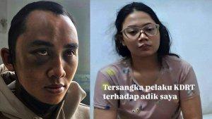 Pegawai-ASN-Ditonjok-Istri-hingga-Lebam-Sempat-tak-Ngaku-di-KDRT-Disuruh-Jalan-Kaki-5-KM-ke-Kantor.jpg