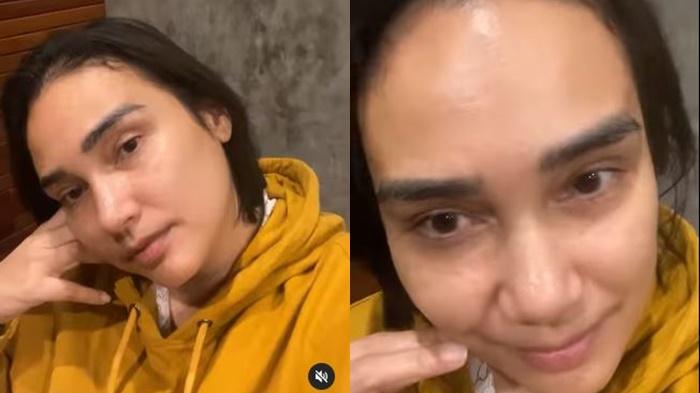 Feby-Febiola-pamerkan-wajahnya-yang-bareface-tanpa-filter-seusai-dinyatakan-sembuh-dari-kanker.jpg