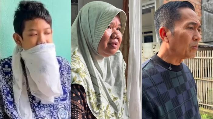 Momen Ratu Dewa Kunjungi Roni, Penyintas Kanker Rahang yang Pernah Dibantu Tahun 2020, Kini Sembuh