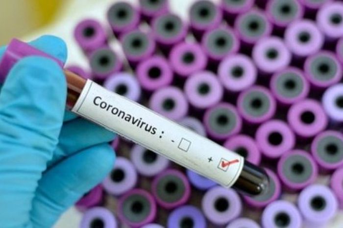 Satu Warga Pagaralam Dinyatakan Positif Corona, Belum Pulang Kampung, Langsung Isolasi di Palembang