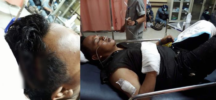 doni-nugraha-korban-begal-menjalani-perawatan_20170727_164135.jpg