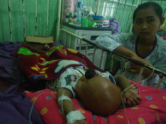 dzaki-pengidap-penyakit-tumor-mata_20170606_110955.jpg