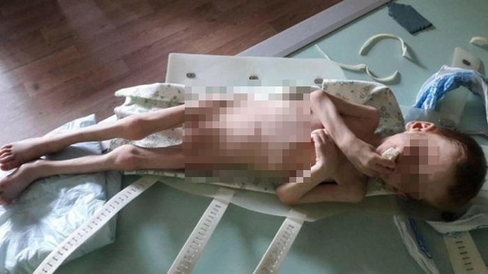 Bocah ini Dibiarkan Hampir Mati Kelaparan oleh Orangtuanya, Sampai Memohon agar Diberi Makanan