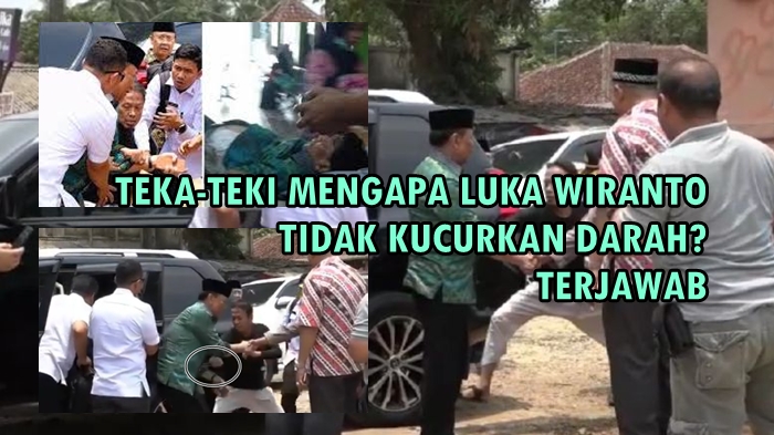Mengapa Tak Ada Darah dari Bekas Luka Wiranto? Ternyata Masuk Lambung, Dokter Jelaskan Bahayanya