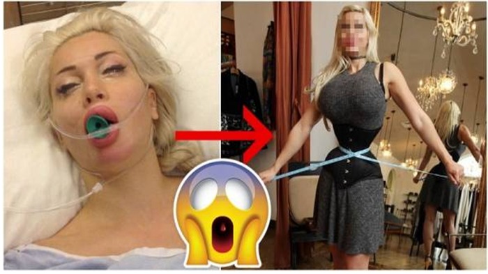 Gadis Ini Rela Buang 6 Tulang Rusuknya & Habiskan Miliaran Rupiah Malah Ini yang Diterimanya