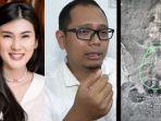 Dokter-Muhammad-Makky-ungkap-jenis-benda-asing-dari-hasil-rontgen-Stevie-Agnecya.jpg