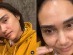 Feby-Febiola-pamerkan-wajahnya-yang-bareface-tanpa-filter-seusai-dinyatakan-sembuh-dari-kanker.jpg