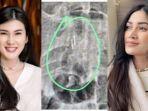 Imbas-dituduh-santet-Stevie-Agnecya-Icha-Anissa-Faradila-emosi-anak-sampai-didoakan-cacat.jpg