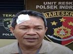 Petaka di Jalinsum Palembang-Indralaya, Kepala Pria Paruh Baya 'Bocor' Dianiaya Sopir Travel