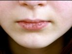 bibir-pecah-pecah_20180927_201929.jpg