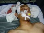 elfran-tansjah-28-yang-melakukan-upaya-bunuh-diri-dengan-menembakkan-senpira-ke-kepalanya_20170929_171848.jpg