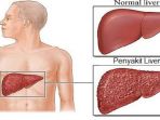 liver2_20181018_210706.jpg